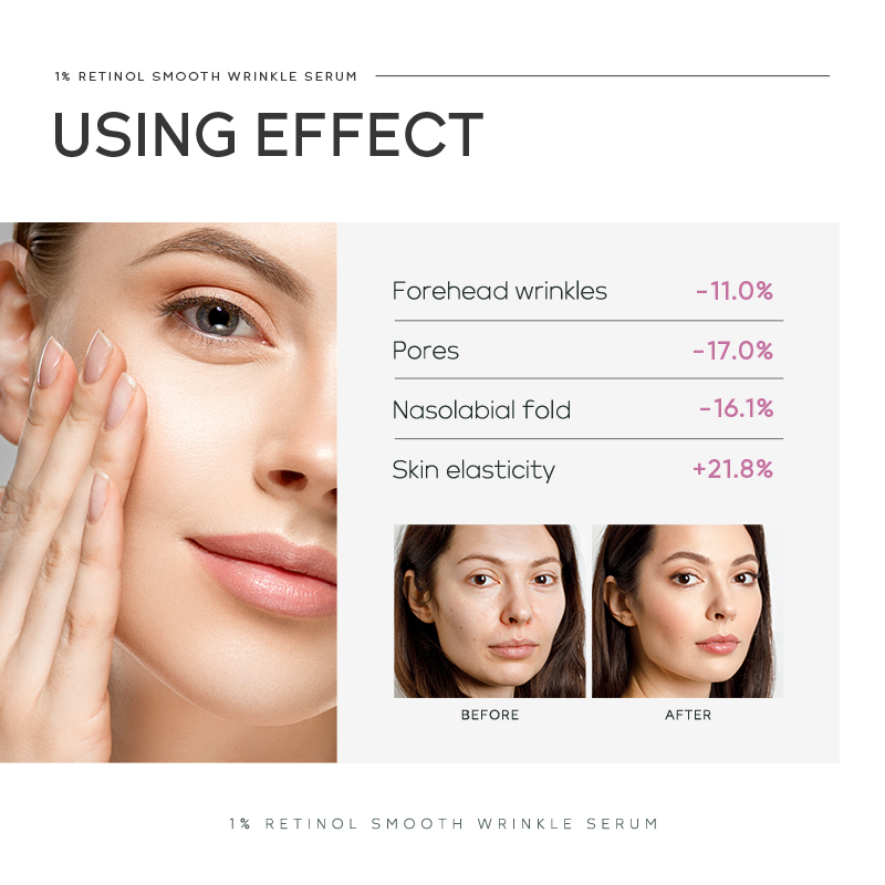 クイユム 1% レチノール スムース リンクル セラム 17 - The Ordinary Serum Hyaluronic Acid のレビューと価格